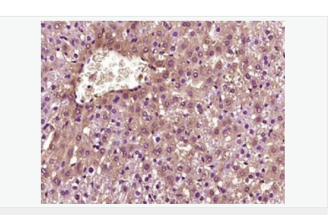 60779984e806f.png image.png