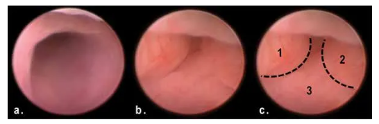 6960aeaeb6628.png image.png